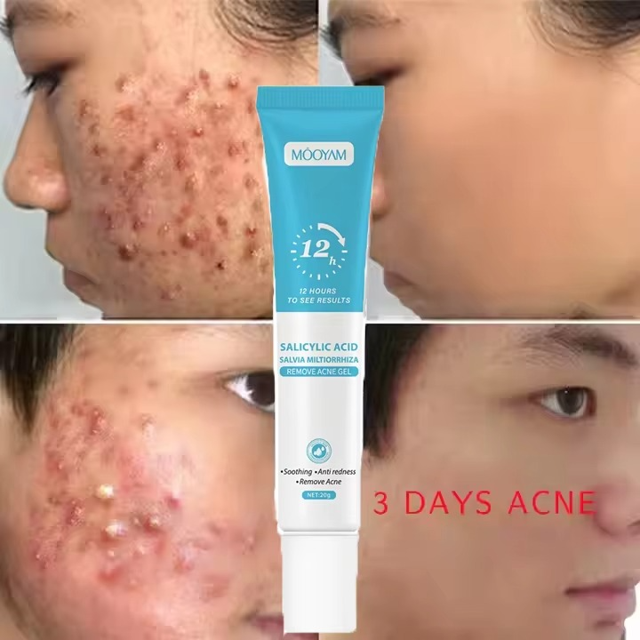 Gel Anti-Imperfections Intense